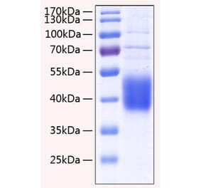 SDS-PAGE - Recombinant Human IL-21R Protein (C-terminal His Tag) (A330867) - Antibodies.com