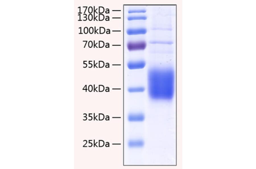 SDS-PAGE - Recombinant Human IL-21R Protein (C-terminal His Tag) (A330867) - Antibodies.com