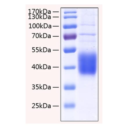 SDS-PAGE - Recombinant Human IL-21R Protein (C-terminal His Tag) (A330867) - Antibodies.com