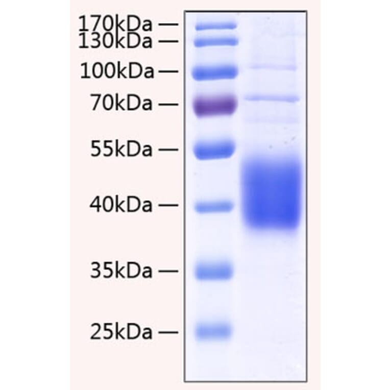 SDS-PAGE - Recombinant Human IL-21R Protein (C-terminal His Tag) (A330867) - Antibodies.com