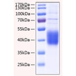 SDS-PAGE - Recombinant Human IL-21R Protein (C-terminal His Tag) (A330867) - Antibodies.com