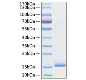 SDS-PAGE - Recombinant Mouse IL-22 Protein (C-terminal His Tag) (A330868) - Antibodies.com