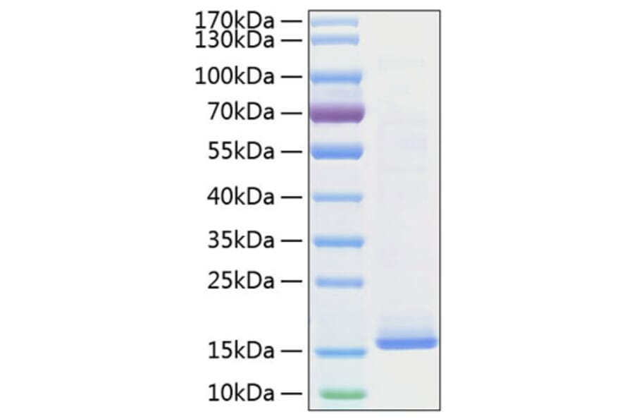 SDS-PAGE - Recombinant Mouse IL-22 Protein (C-terminal His Tag) (A330868) - Antibodies.com