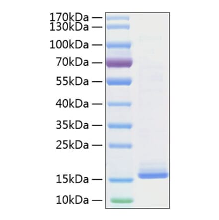 SDS-PAGE - Recombinant Mouse IL-22 Protein (C-terminal His Tag) (A330868) - Antibodies.com