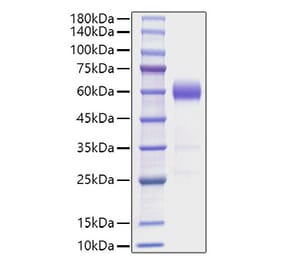 SDS-PAGE - Recombinant Mouse IL-22 Protein (C-terminal Human Fc Tag) (A330869) - Antibodies.com