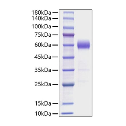 SDS-PAGE - Recombinant Mouse IL-22 Protein (C-terminal Human Fc Tag) (A330869) - Antibodies.com