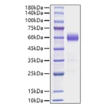 SDS-PAGE - Recombinant Mouse IL-22 Protein (C-terminal Human Fc Tag) (A330869) - Antibodies.com