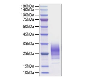 SDS-PAGE - Recombinant Human IL-22 Protein (C-terminal His Tag) (A330870) - Antibodies.com