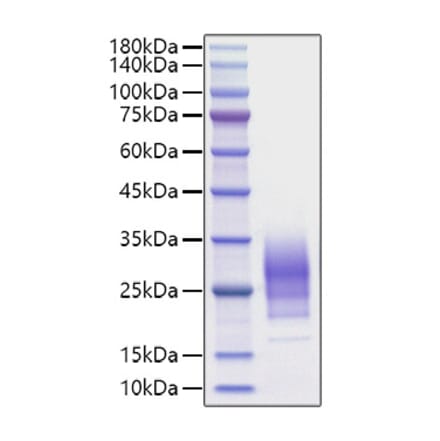 SDS-PAGE - Recombinant Human IL-22 Protein (C-terminal His Tag) (A330870) - Antibodies.com
