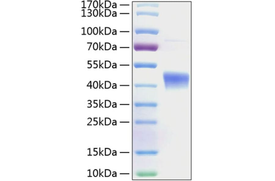 SDS-PAGE - Recombinant Human IL-22RA2 Protein (C-terminal His Tag) (A330871) - Antibodies.com