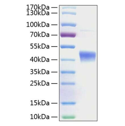 SDS-PAGE - Recombinant Human IL-22RA2 Protein (C-terminal His Tag) (A330871) - Antibodies.com