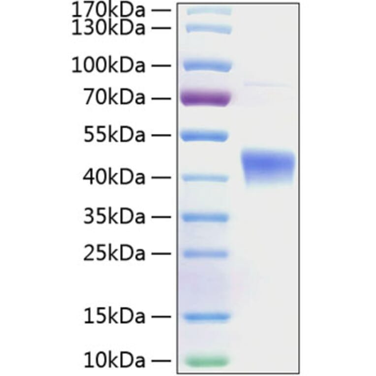 SDS-PAGE - Recombinant Human IL-22RA2 Protein (C-terminal His Tag) (A330871) - Antibodies.com