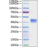 SDS-PAGE - Recombinant Human IL-22RA2 Protein (C-terminal His Tag) (A330871) - Antibodies.com