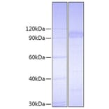 SDS-PAGE - Recombinant Mouse IL-23R Protein (C-terminal Fc Tag) (A330872) - Antibodies.com