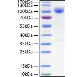 SDS-PAGE - Recombinant Human IL-23R Protein (C-terminal Human Fc Tag) (A330873) - Antibodies.com