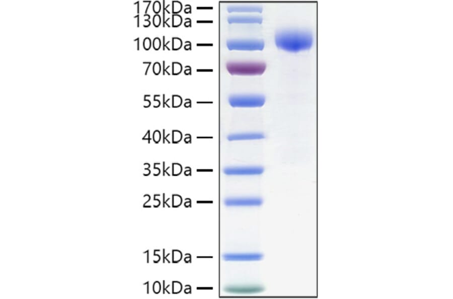 SDS-PAGE - Recombinant Human IL-23R Protein (C-terminal Human Fc Tag) (A330873) - Antibodies.com