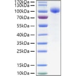 SDS-PAGE - Recombinant Human IL-23R Protein (C-terminal Human Fc Tag) (A330873) - Antibodies.com