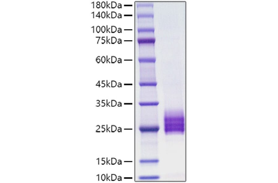 SDS-PAGE - Recombinant human IL-25 Protein (C-terminal His Tag) (A330874) - Antibodies.com