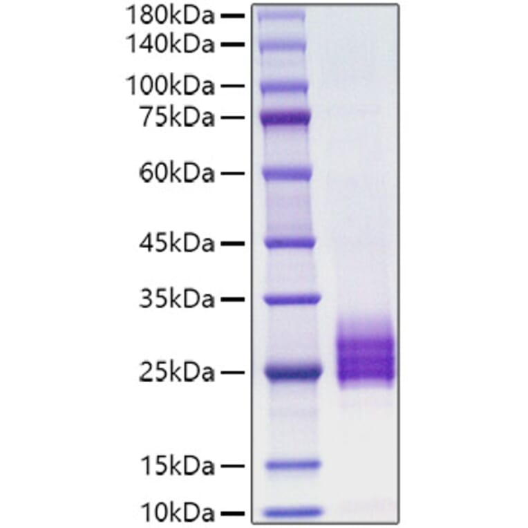 SDS-PAGE - Recombinant human IL-25 Protein (C-terminal His Tag) (A330874) - Antibodies.com