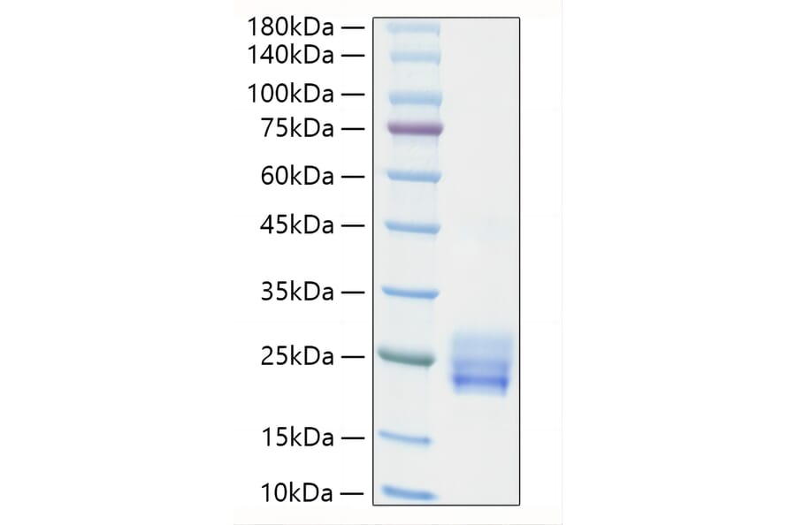 SDS-PAGE - Recombinant Human IL-25 Protein (N-terminal His Tag) (A330875) - Antibodies.com