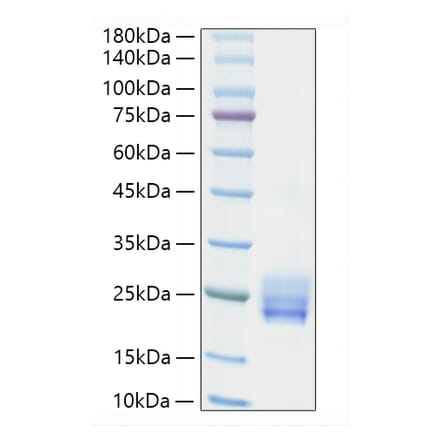 SDS-PAGE - Recombinant Human IL-25 Protein (N-terminal His Tag) (A330875) - Antibodies.com