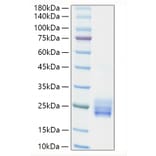 SDS-PAGE - Recombinant Human IL-25 Protein (N-terminal His Tag) (A330875) - Antibodies.com