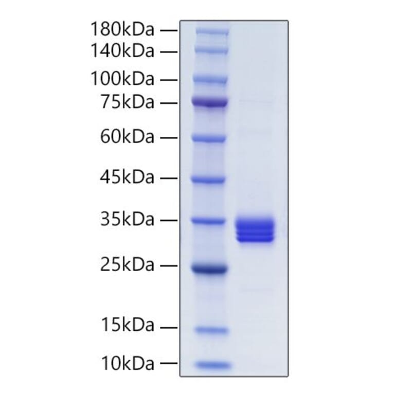 SDS-PAGE - Recombinant Human IL-27-A + EBI3 Protein (N-terminal His and NO Tag) (A330876) - Antibodies.com