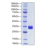 SDS-PAGE - Recombinant Human IL-27-A + EBI3 Protein (N-terminal His and NO Tag) (A330876) - Antibodies.com