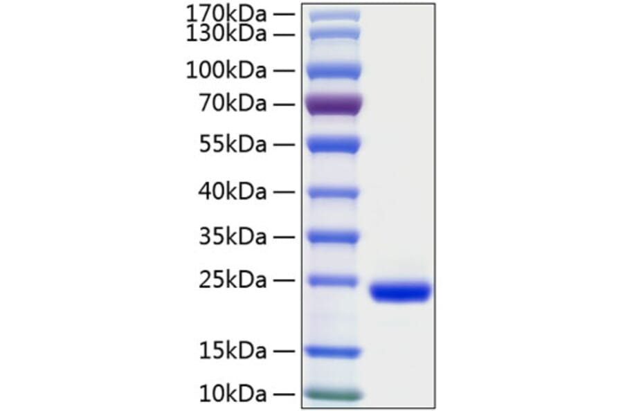 SDS-PAGE - Recombinant Human IL-28A Protein (C-terminal His Tag) (A330877) - Antibodies.com