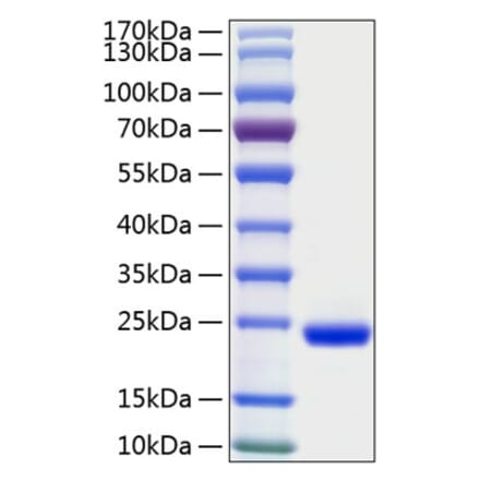 SDS-PAGE - Recombinant Human IL-28A Protein (C-terminal His Tag) (A330877) - Antibodies.com