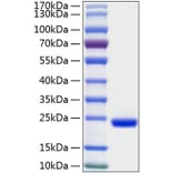 SDS-PAGE - Recombinant Human IL-28A Protein (C-terminal His Tag) (A330877) - Antibodies.com