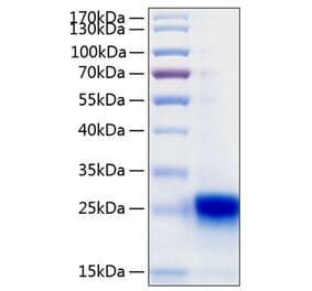 SDS-PAGE - Recombinant Human IL-28B Protein (C-terminal His Tag) (A330878) - Antibodies.com