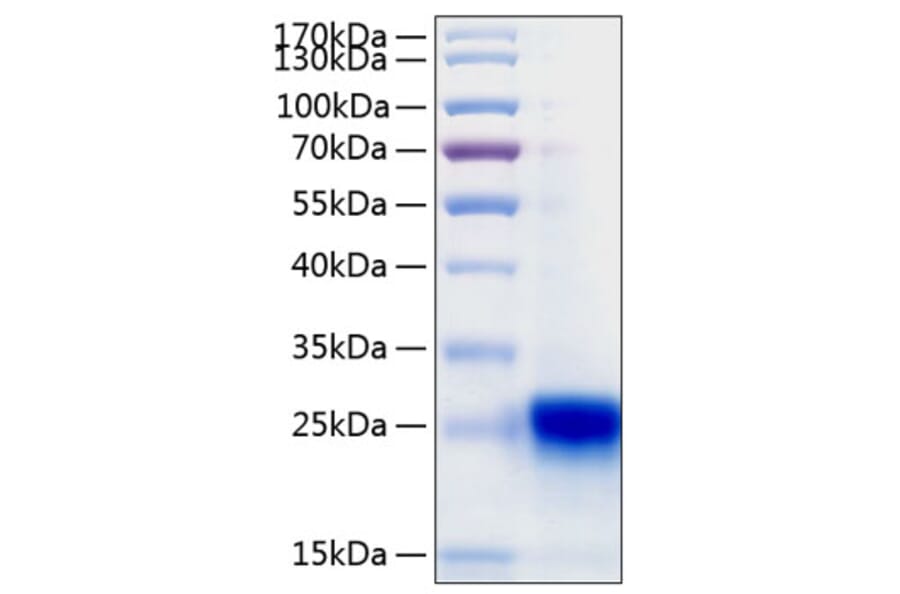 SDS-PAGE - Recombinant Human IL-28B Protein (C-terminal His Tag) (A330878) - Antibodies.com