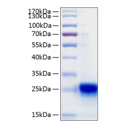 SDS-PAGE - Recombinant Human IL-28B Protein (C-terminal His Tag) (A330878) - Antibodies.com