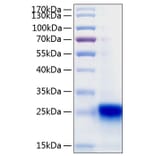 SDS-PAGE - Recombinant Human IL-28B Protein (C-terminal His Tag) (A330878) - Antibodies.com
