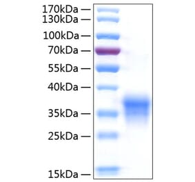 SDS-PAGE - Recombinant Human IL-29 Protein (C-terminal His Tag) (A330879) - Antibodies.com