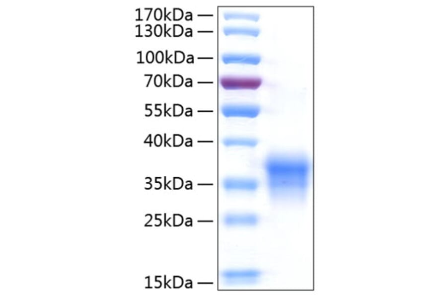 SDS-PAGE - Recombinant Human IL-29 Protein (C-terminal His Tag) (A330879) - Antibodies.com