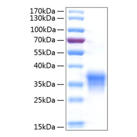 SDS-PAGE - Recombinant Human IL-29 Protein (C-terminal His Tag) (A330879) - Antibodies.com