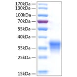 SDS-PAGE - Recombinant Human IL-29 Protein (C-terminal His Tag) (A330879) - Antibodies.com