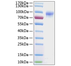 SDS-PAGE - Recombinant Human IL-2RG Protein (C-terminal Human Fc and His Tag) (A330880) - Antibodies.com