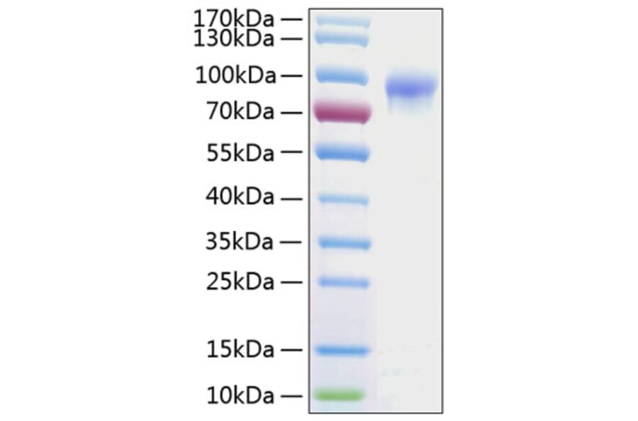 SDS-PAGE - Recombinant Human IL-2RG Protein (C-terminal Human Fc and His Tag) (A330880) - Antibodies.com