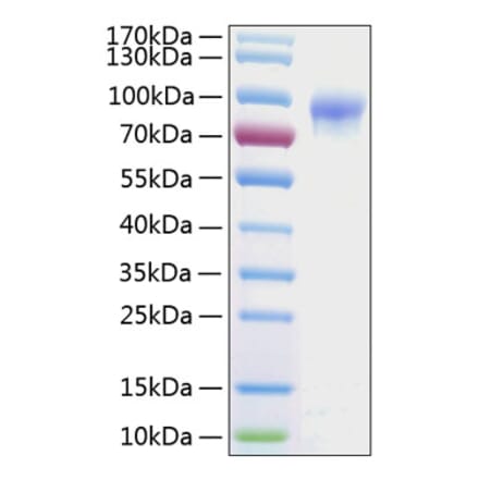 SDS-PAGE - Recombinant Human IL-2RG Protein (C-terminal Human Fc and His Tag) (A330880) - Antibodies.com