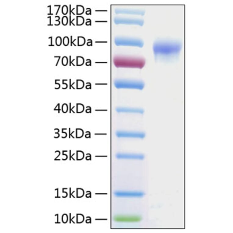 SDS-PAGE - Recombinant Human IL-2RG Protein (C-terminal Human Fc and His Tag) (A330880) - Antibodies.com