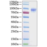 SDS-PAGE - Recombinant Human IL-2RG Protein (C-terminal Human Fc and His Tag) (A330880) - Antibodies.com