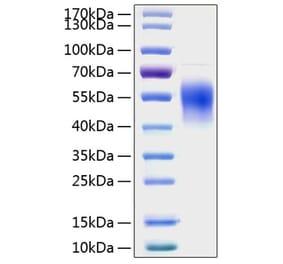 SDS-PAGE - Recombinant Human IL-2RG Protein (C-terminal His Tag) (A330881) - Antibodies.com