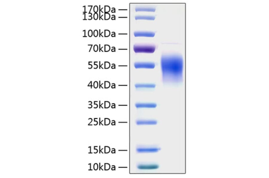 SDS-PAGE - Recombinant Human IL-2RG Protein (C-terminal His Tag) (A330881) - Antibodies.com