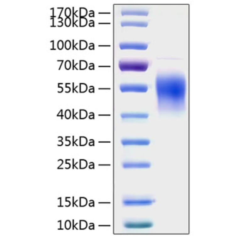 SDS-PAGE - Recombinant Human IL-2RG Protein (C-terminal His Tag) (A330881) - Antibodies.com