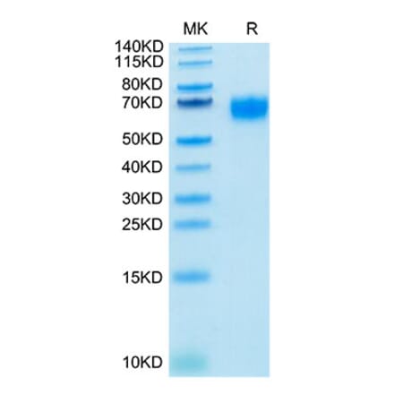 Tris-Bis PAGE - Recombinant Human IL-2RG Protein (Biotin) (C-terminal His and Avi Tag) (A330882) - Antibodies.com