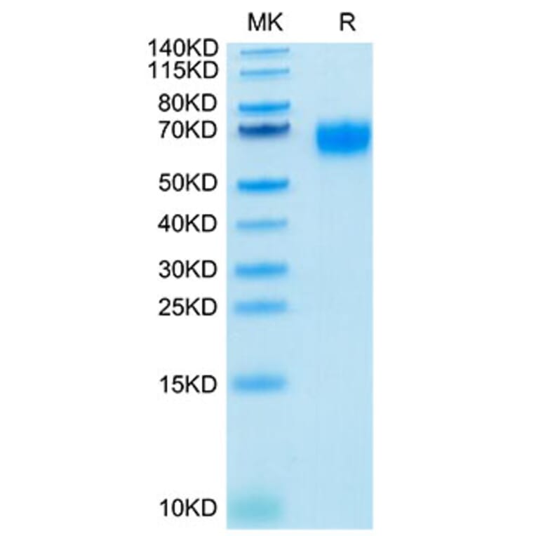 Tris-Bis PAGE - Recombinant Human IL-2RG Protein (Biotin) (C-terminal His and Avi Tag) (A330882) - Antibodies.com