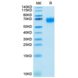 Tris-Bis PAGE - Recombinant Human IL-2RG Protein (Biotin) (C-terminal His and Avi Tag) (A330882) - Antibodies.com